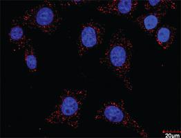 Anti-FLT1 + CRKL Antibody Pair