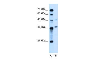 Anti-ARMCX6 Rabbit Polyclonal Antibody