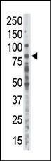 Anti-PRKCA Rabbit Polyclonal Antibody