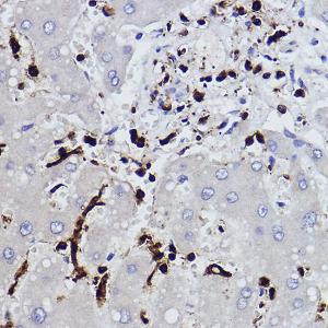 Anti-Plastin L Rabbit Monoclonal Antibody [clone: ARC2689]