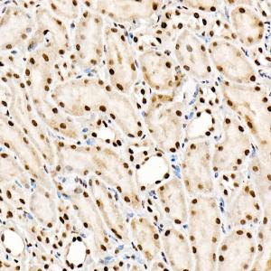 Immunohistochemistry analysis of paraffin-embedded rat kidney using Anti-SF2 Antibody [ARC51453] (A306007) at a dilution of 1:100 (40X lens). Perform high pressure antigen retrieval with 10 mM citrate buffer pH 6.0 before commencing with IHC staining protocol