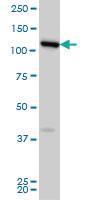 Anti-CCDC132 Mouse Monoclonal Antibody [clone: 2D11]