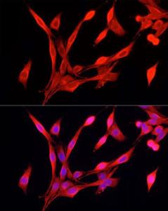 Immunofluorescence analysis of PC-12 cells using Anti-FPRL1 / RFP Antibody (A309939) at a dilution of 1:50 (40x lens). DAPI was used to stain the cell nuclei (blue).