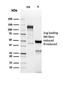 Anti-TdT Rabbit Recombinant Antibody [Clone: DNTT/4617R]