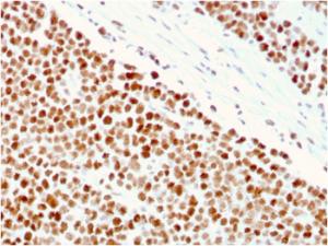 Immunohistochemical analysis of formalin-fixed, paraffin-embedded human small intestine using Anti-MSH6 Antibody [MSH6/3086]