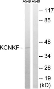 Western blot analysis of lysates from A549 cells using Anti-KCNK15 Antibody. The right hand lane represents a negative control, where the antibody is blocked by the immunising peptide