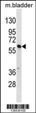 Anti-SNX30 Rabbit Polyclonal Antibody (AP (Alkaline Phosphatase))