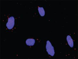 Anti-MAPK3 + MAPK1 Antibody Pair