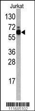 Anti-RPS6KB1 Rabbit Polyclonal Antibody (AP (Alkaline Phosphatase))