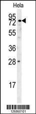 Anti-IDUA Rabbit Polyclonal Antibody (FITC (Fluorescein Isothiocyanate))