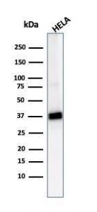 Western blot analysis of HeLa cell lysate using Anti-AKR1B1 Antibody [CPTC-AKR1B1-2]