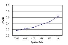 Anti-ITGB5 Antibody Pair