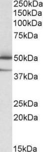 Anti-TXNDC5 Antibody (A82766) (0.05 µg/ml) staining of Human Lymph Nodes lysate (35 µg protein in RIPA buffer). Primary incubation was 1 hour. Detected by chemiluminescence