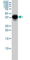 Anti-MAGEA9 Mouse Monoclonal Antibody [clone: 1C2]