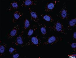 Anti-PDGFRB + CRKL Antibody Pair