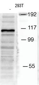 Anti-Mib1/Mindbomb Rabbit Polyclonal Antibody