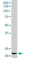 Anti-NDUFV2 Mouse Monoclonal Antibody [clone: 1A10]