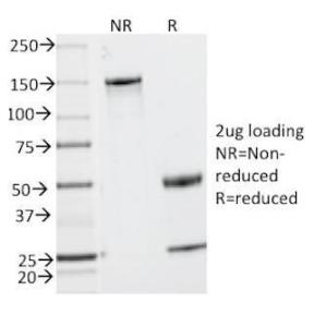 SDS-PAGE analysis of Anti-MUC2 Antibody [MLP/842] under non-reduced and reduced conditions; showing intact IgG and intact heavy and light chains, respectively. SDS-PAGE analysis confirms the integrity and purity of the antibody