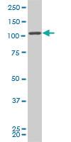 Anti-CCDC132 Mouse Monoclonal Antibody [clone: 2D11]