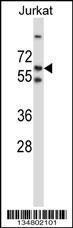 Anti-LCK Rabbit Polyclonal Antibody (HRP (Horseradish Peroxidase))