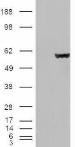 HEK293 overexpressing Fumarase (RC200614) and probed with Anti-FH Antibody (A84362) (mock transfection in first lane), tested by Origene