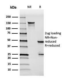 SDS-PAGE analysis of Anti-Mesothelin Antibody [MSLN/3384] under non-reduced and reduced conditions; showing intact IgG and intact heavy and light chains, respectively. SDS-PAGE analysis confirms the integrity and purity of the Antibody