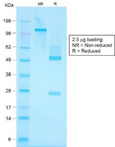 SDS-PAGE analysis of Anti-Keratin 76 Antibody [KRTH/1576R] under non-reduced and reduced conditions; showing intact IgG and intact heavy and light chains, respectively. SDS-PAGE analysis confirms the integrity and purity of the antibody