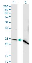 Anti-NDUFV2 Mouse Monoclonal Antibody [clone: 1A10]