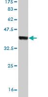 Anti-HECTD1 Mouse Monoclonal Antibody [clone: 1E10]