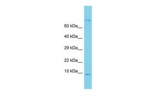 Anti-GAGE6 Rabbit Polyclonal Antibody