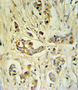 Anti-FGB Rabbit Polyclonal Antibody