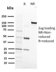 SDS-PAGE analysis of Anti-VEGF Receptor 1 Antibody [FLT1/658] under non-reduced and reduced conditions; showing intact IgG and intact heavy and light chains, respectively. SDS-PAGE analysis confirms the integrity and purity of the antibody