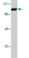 Anti-ADARB1 Sheep Polyclonal Antibody