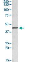 Anti-ACAT1 Goat Polyclonal Antibody