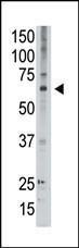 Anti-MAGED2 Rabbit Polyclonal Antibody (HRP (Horseradish Peroxidase))