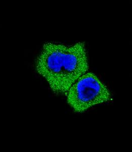 Anti-SMAD7 Rabbit Polyclonal Antibody