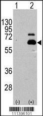 Anti-RPS6KB1 Rabbit Polyclonal Antibody (APC (Allophycocyanin))