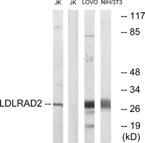 Western blot analysis of lysates from Jurkat, LOVO, and NIH/3T3 cells using Anti-LDLRAD2 Antibody. The right hand lane represents a negative control, where the antibody is blocked by the immunising peptide.