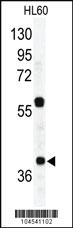 Anti-RAD23A Rabbit Polyclonal Antibody