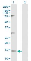 Anti-NDUFV3 Rabbit Polyclonal Antibody