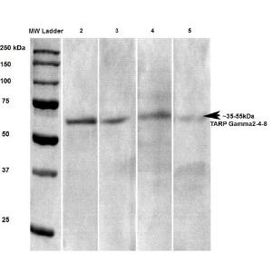 Western blot analysis of rat brain lysates showing detection of Stargazin Calcium Channel protein using Anti-Stargazin Antibody [S245-36] (A304819) at 1:100, 1:250, 1:500, and 1:1000