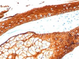 Immunohistochemical analysis of formalin-fixed, paraffin-embedded human skin using Anti-Keratin 76 Antibody [KRTH/4392R]