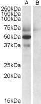 Anti-APOL4 Antibody (A82768) (0.5µg/ml) staining of Human Placenta lysate (35µg protein in RIPA buffer) with (B) and without (A) blocking with the immunising peptide. Detected by chemiluminescence.