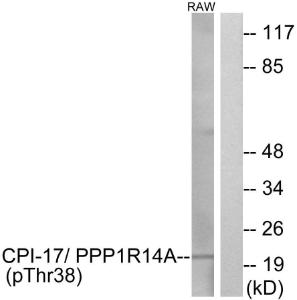 Western blot analysis of lysates from RAW264.7 cells using Anti-CPI17 alpha (phospho Thr38) Antibody. The right hand lane represents a negative control, where the antibody is blocked by the immunising peptide