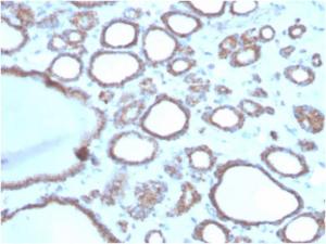 Immunohistochemical analysis of formalin-fixed, paraffin-embedded human thyroid using Anti-DBC2 Antibody [DBC2/3362]