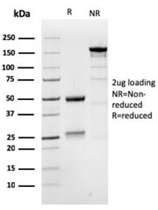 SDS-PAGE analysis of Anti-MSH6 Antibody [MSH6/3086] under non-reduced and reduced conditions; showing intact IgG and intact heavy and light chains, respectively. SDS-PAGE analysis confirms the integrity and purity of the antibody.