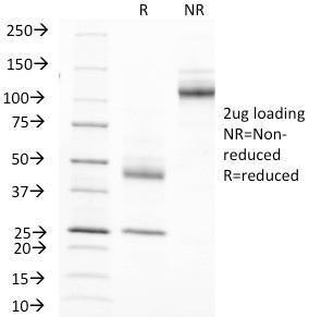 SDS-PAGE analysis of Anti-MUC1 Antibody [MUC1/845] under non-reduced and reduced conditions; showing intact IgG and intact heavy and light chains, respectively. SDS-PAGE analysis confirms the integrity and purity of the antibody