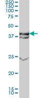 Anti-MAP Kinase 3 Mouse Monoclonal Antibody [clone: 3C9]