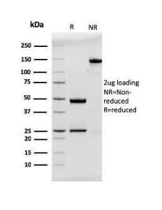 SDS-PAGE analysis of Anti-MUC2 Antibody [rmlP/842] under non-reduced and reduced conditions; showing intact IgG and intact heavy and light chains, respectively. SDS-PAGE analysis confirms the integrity and purity of the antibody