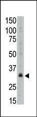 Anti-MAGEA6 Rabbit Polyclonal Antibody (Biotin)